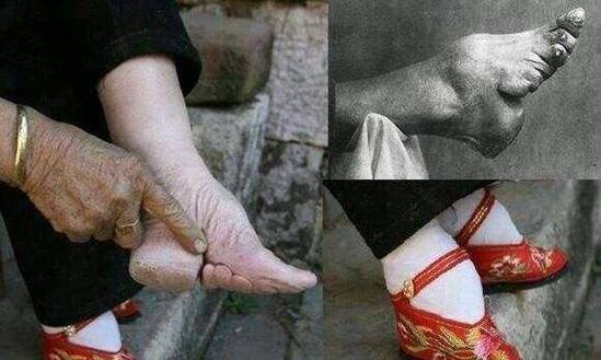 为何缠足要称为三寸金莲,三寸金莲裹脚布-第2张图片-文史 为何缠足要称为三寸金莲,三寸金莲裹脚布-第2张图片-文史